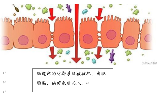 潜藏的健康"杀手"——肠漏
