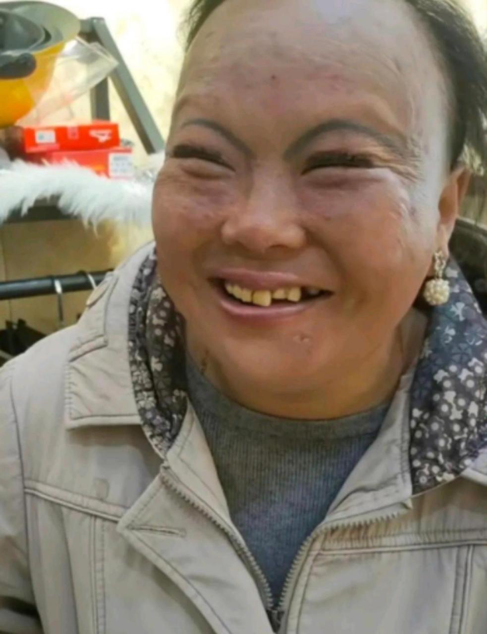 我们村里的可怜人,因为长的丑,年轻时被丈夫抛弃,后来儿子儿媳也嫌弃