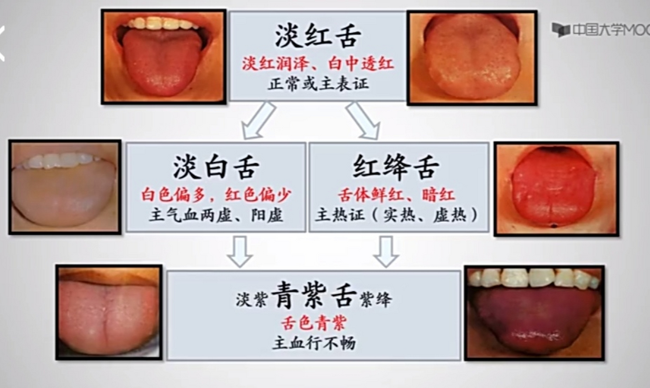 中医"望诊"望舌质一一意义,特征,异常表现,正常为淡红舌,淡白舌为虚证