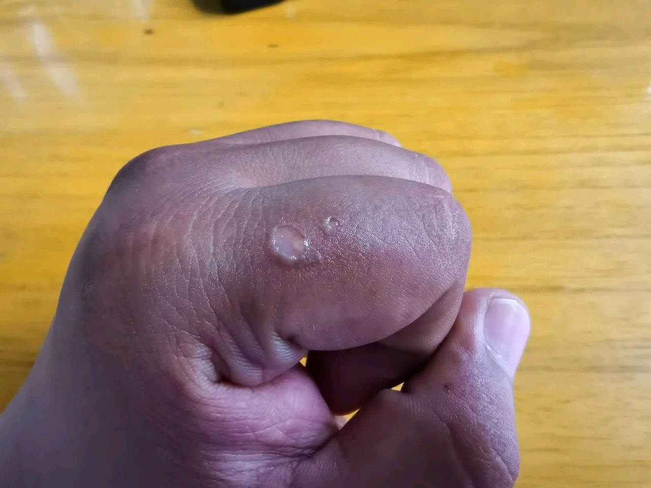 让洋辣子蛰了,闺女给我出个主意.@彬仔说事儿的动态