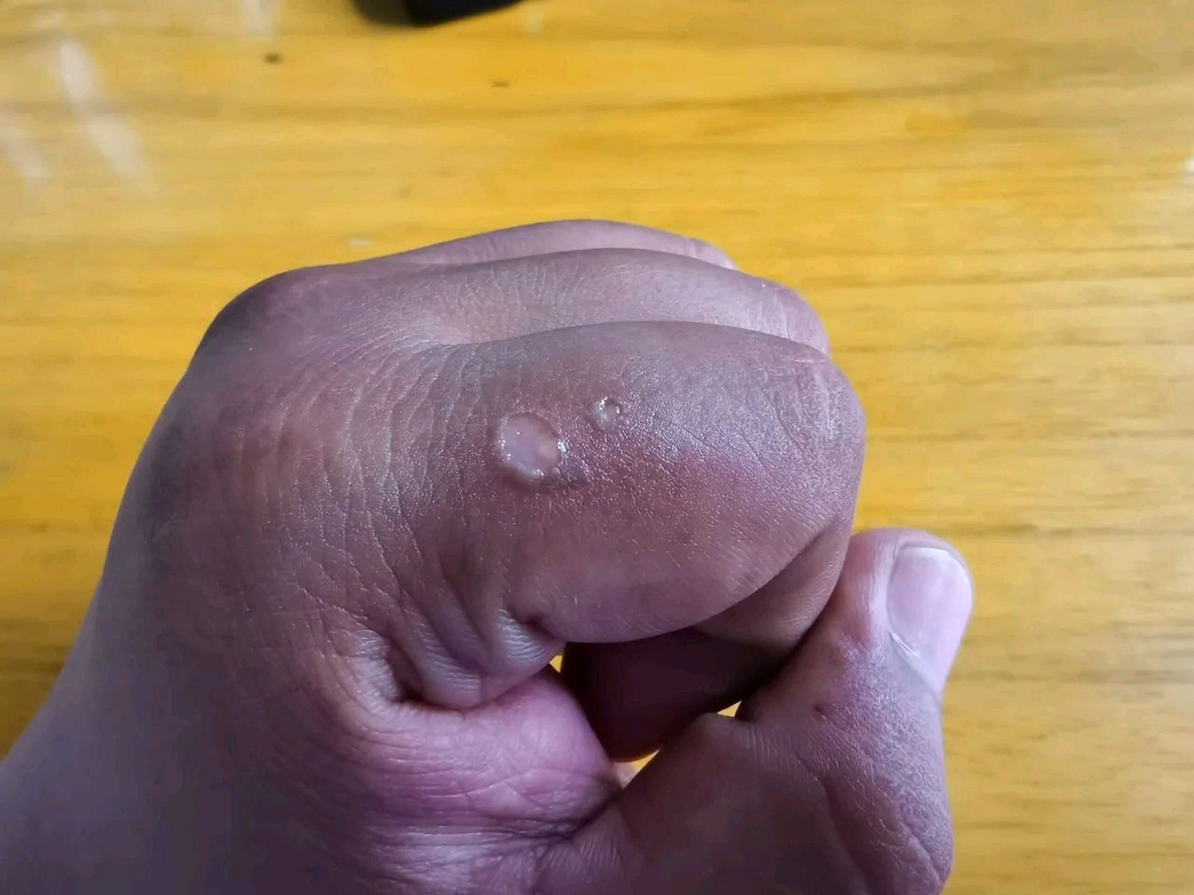 枣还没熟,我也不知道怎么那么手欠,非要摘一个尝尝,没寻思让洋辣子蛰