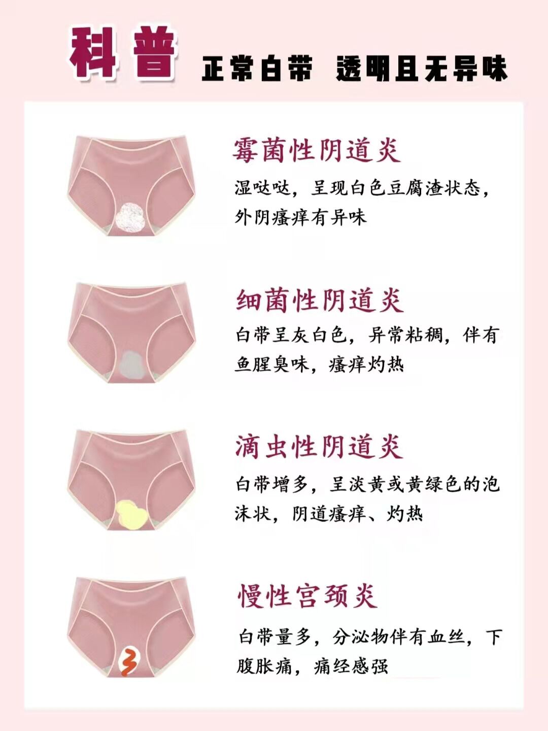 妇科炎症自测表