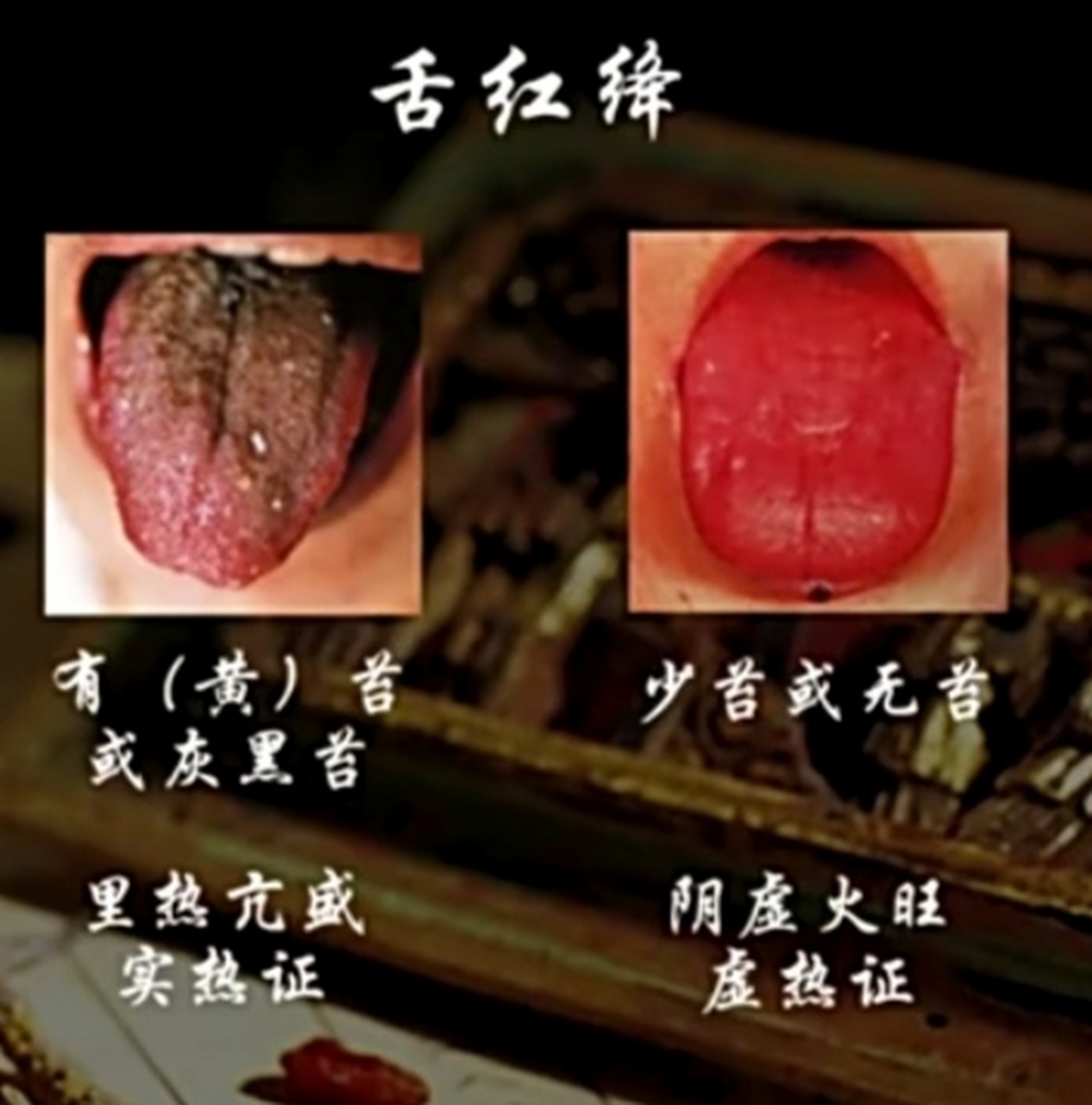 中医"望诊"望舌质一一意义,特征,异常表现,正常为淡红舌,淡白舌为虚证