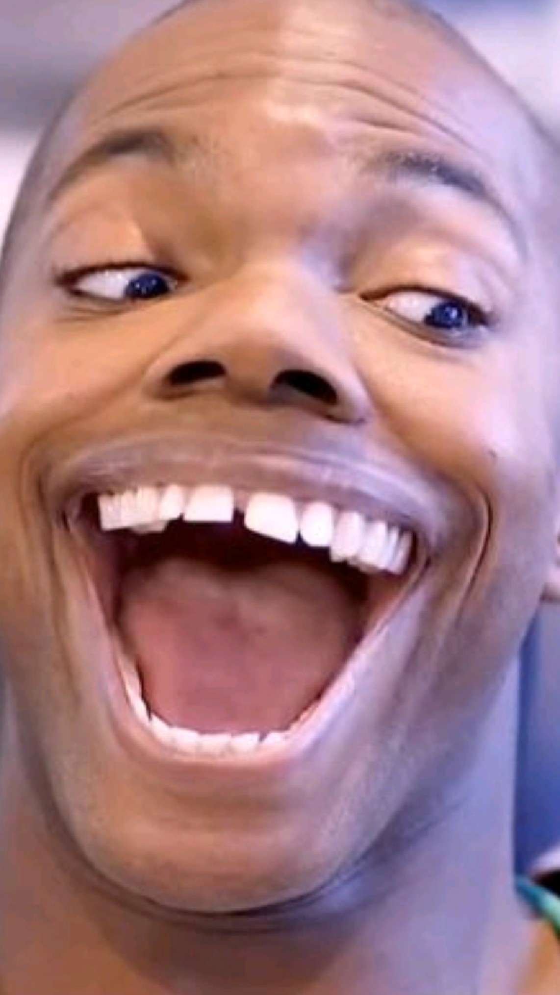 男子看牙医嘴巴张不大,女助理一招解决,果然男人本性都好色!