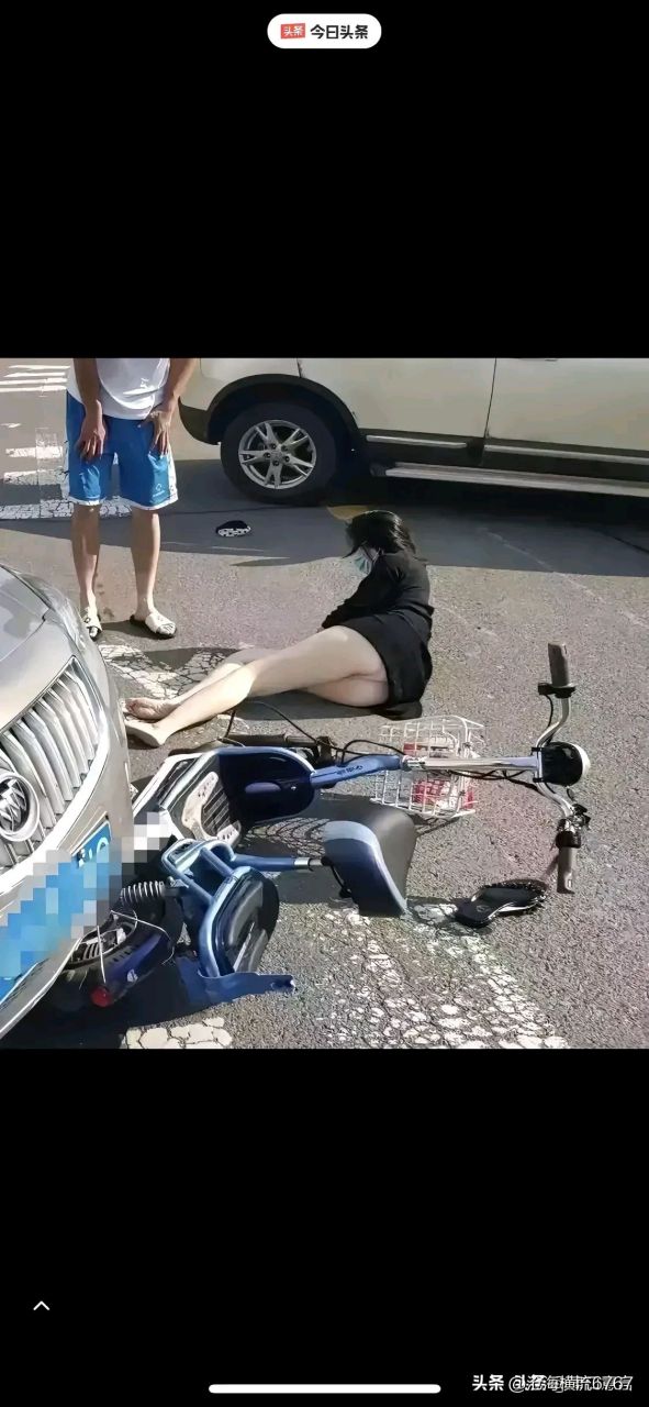 还好,这应该撞的不严重,骑车最好不要穿超短裙啊.