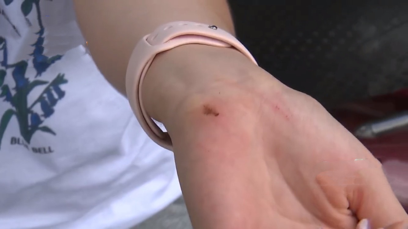 女子骑车摔倒磨破鞋,欲找维修老板索赔:都怪他把车速提太快