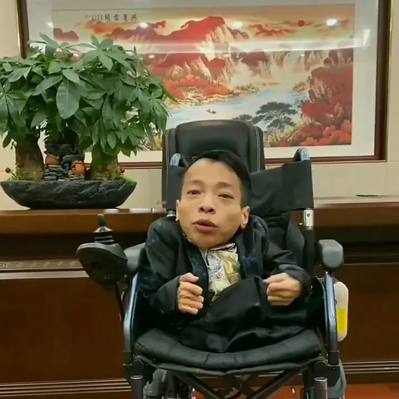 李创利是一位身高不到一米,体重不到三十斤的先天性脆骨病人.