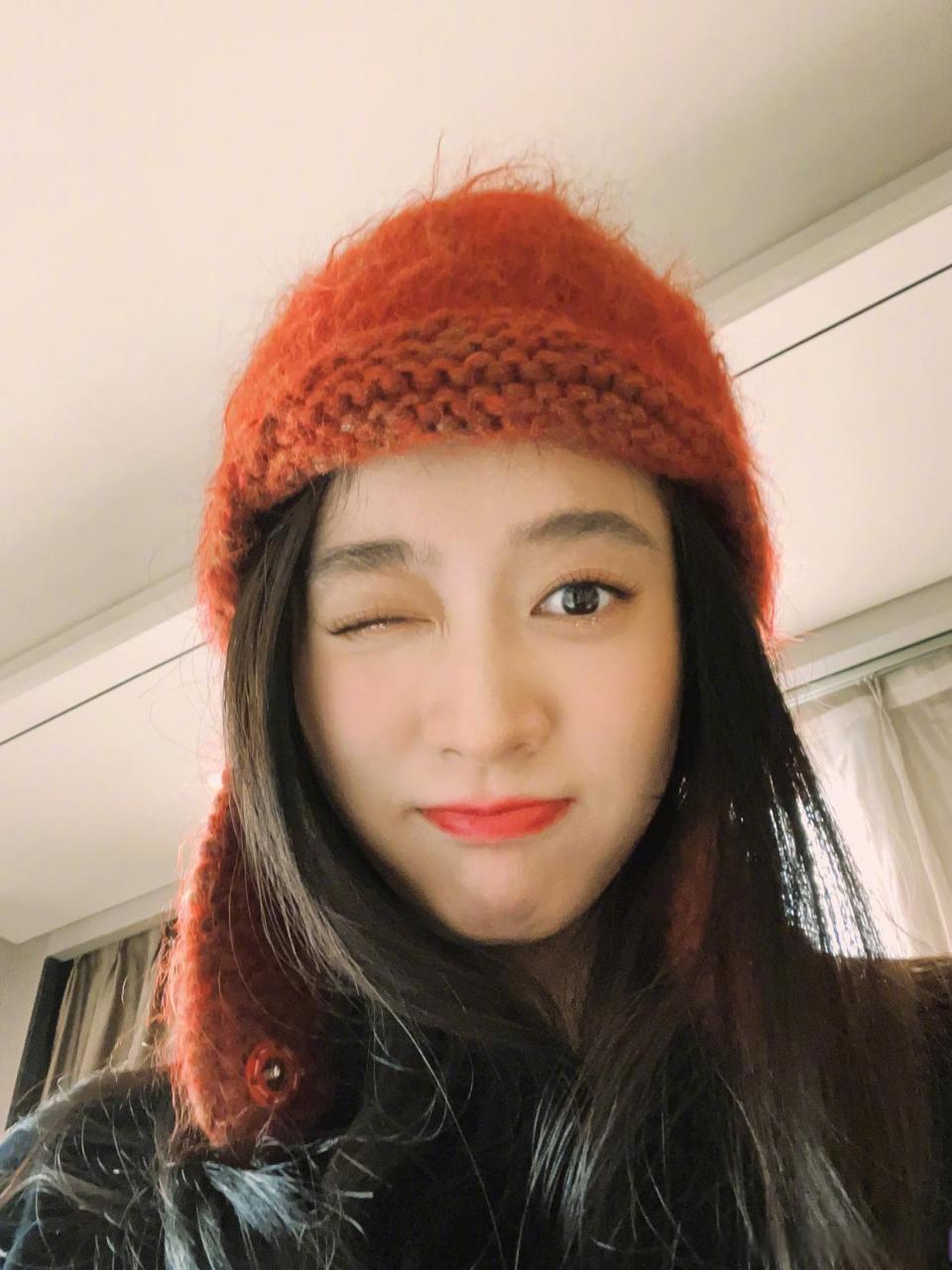 最美小虎牙美女!张雪迎