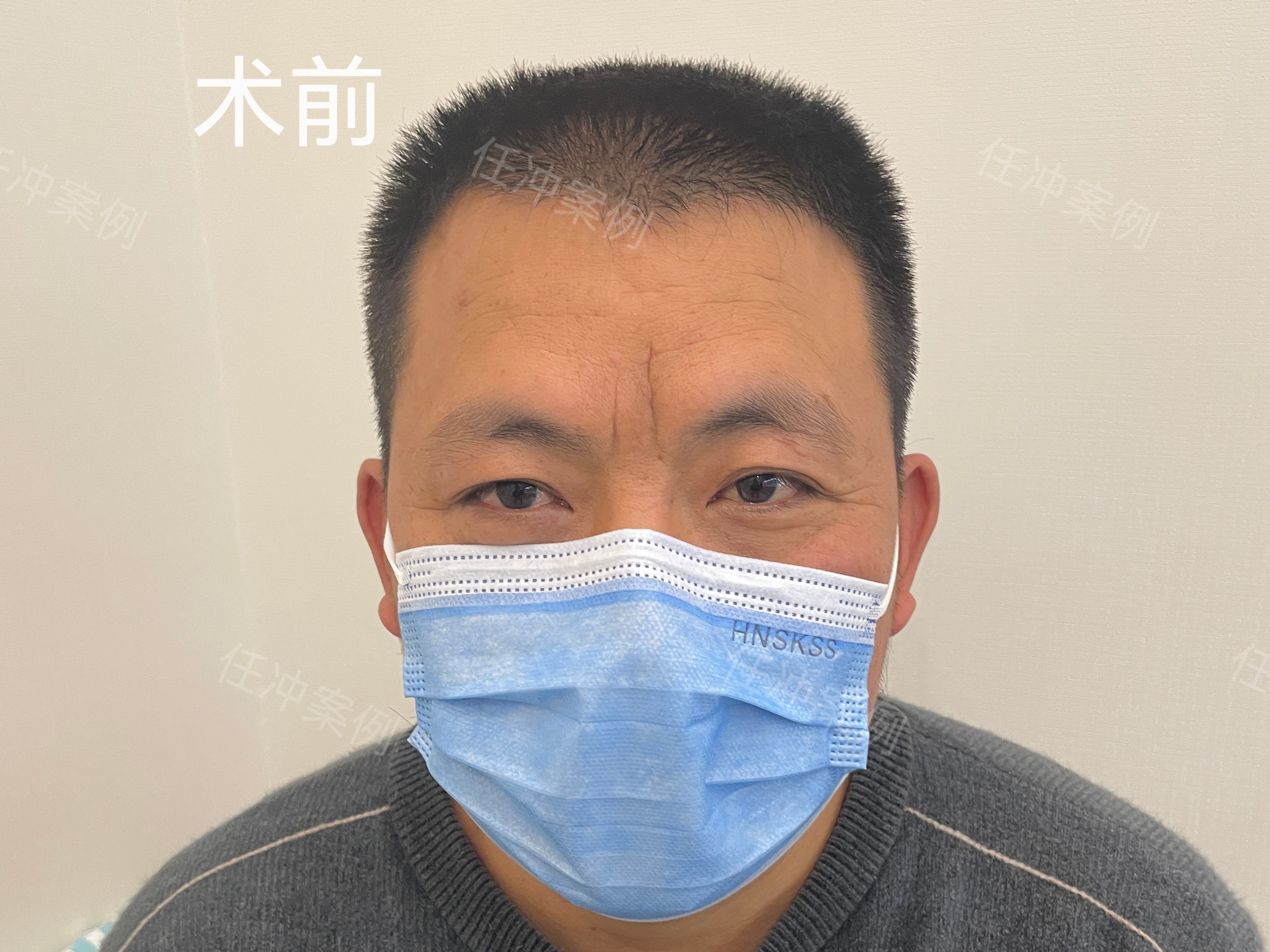 打虎亲兄弟,上阵父子兵,整形夫妻档