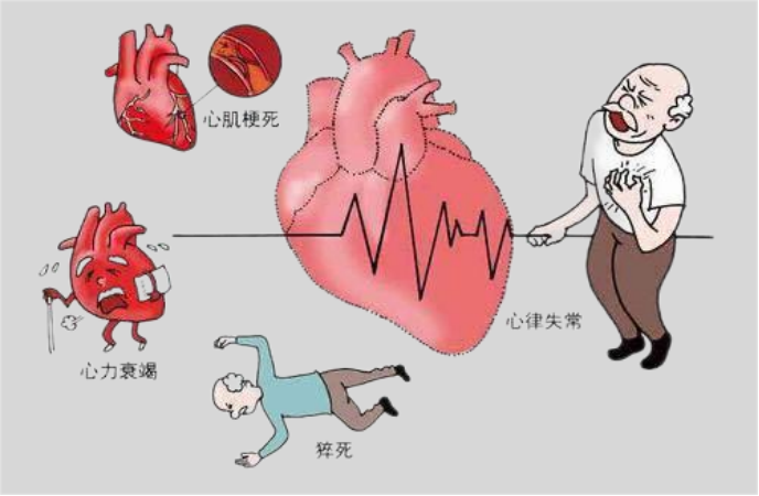 心脏病发作图片卡通图片