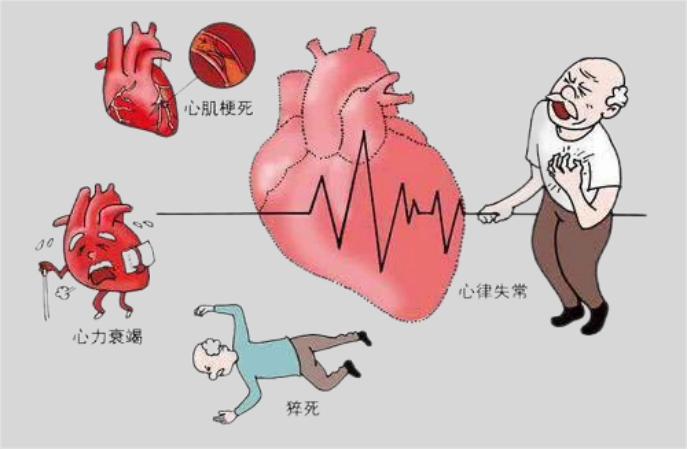 心绞痛发作动画图片图片