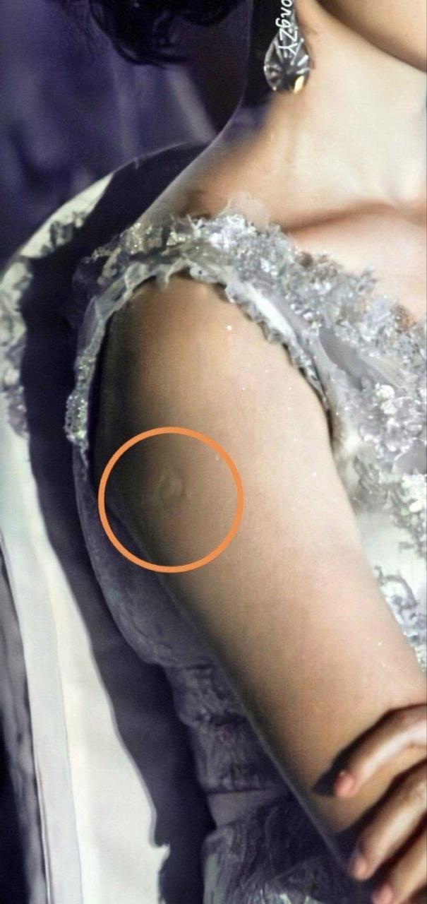 新谈的女朋友,为什么胳膊上有这个痕迹,是守宫砂吗?