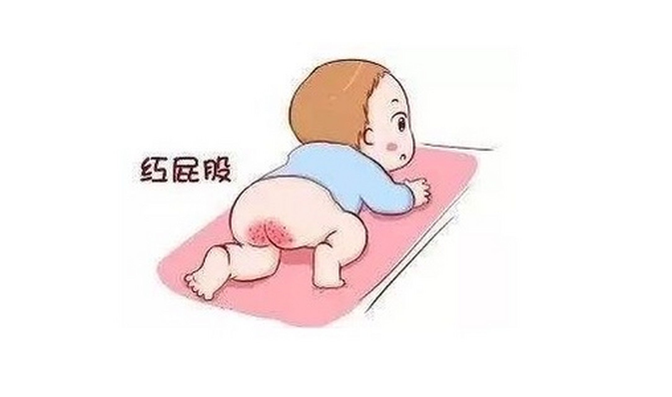必须这么做,一天就有效 宝宝红屁屁,是很多新手妈妈和爸爸头痛的问题