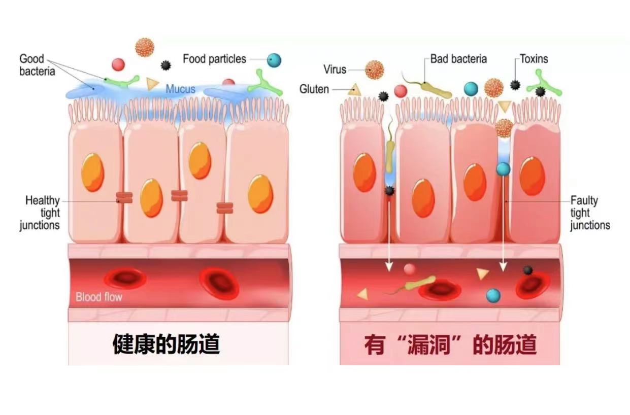 漏肠症状图片