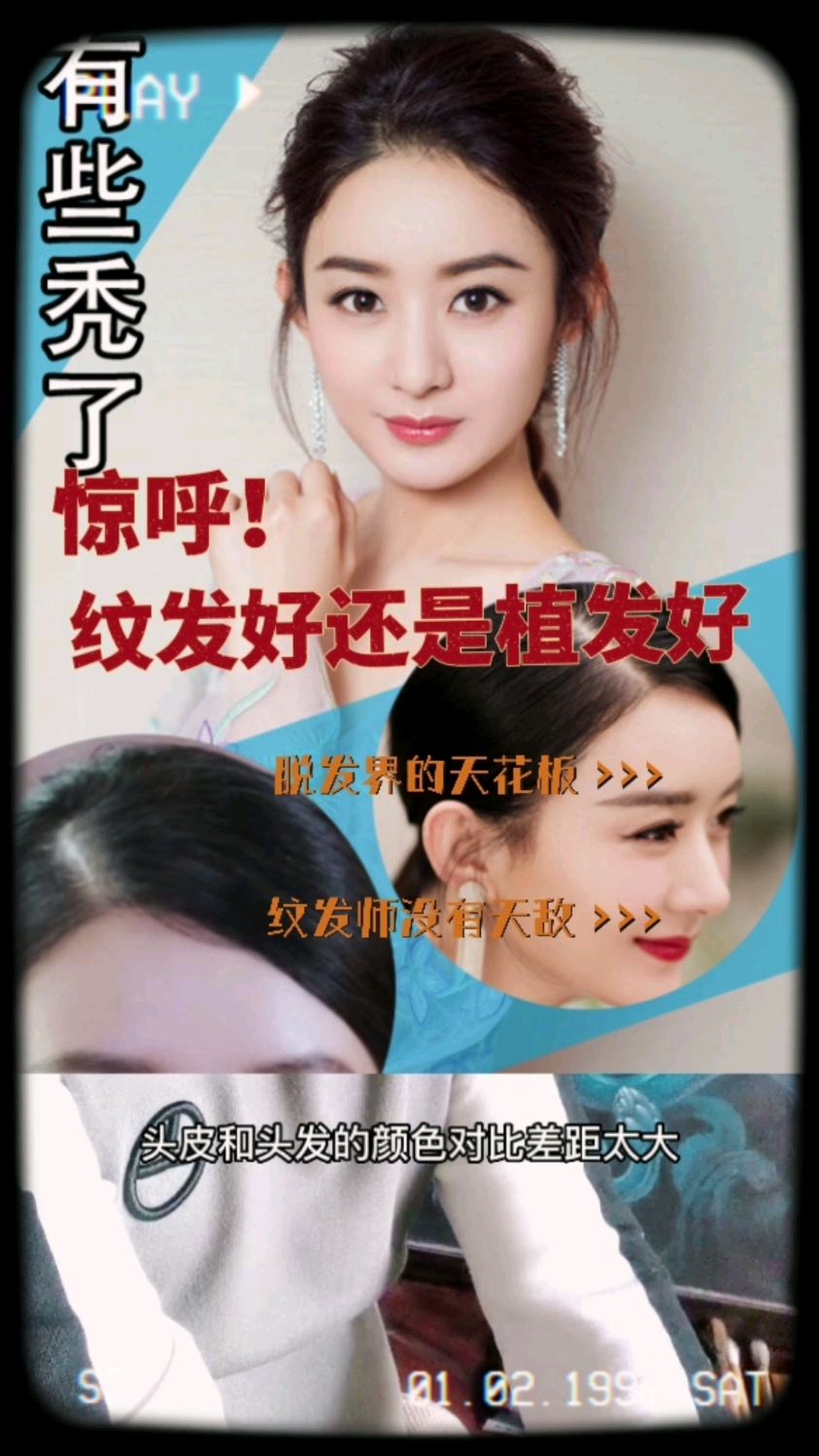 植发和纹发的区别 植发好还是纹发好-度小视