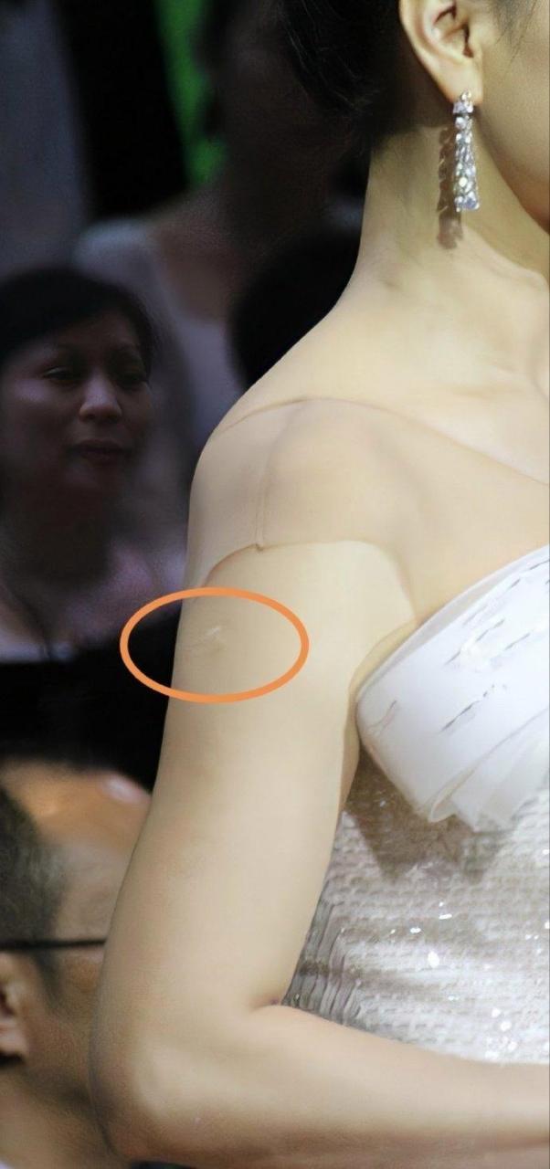 新谈的女朋友,为什么胳膊上有这个痕迹,是守宫砂吗?