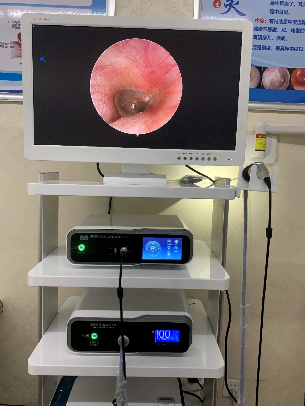 可视采耳设备可视采耳仪器可视掏耳机器可视采耳培训