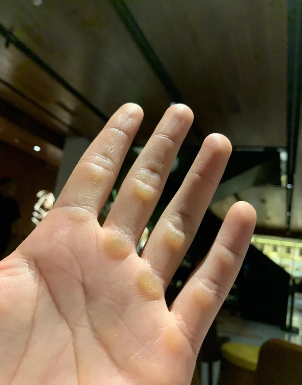 细腻出油手,老茧手,人生就是如此不同 #搞笑