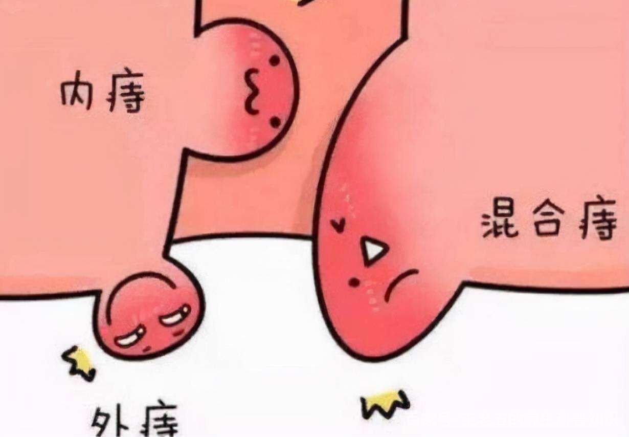 痔仓 baijiahao.baidu.com
