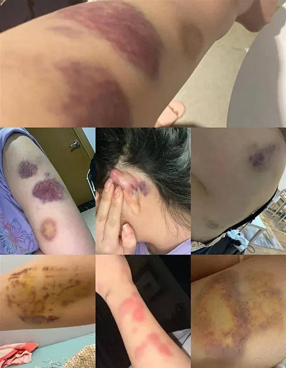 12岁女童遭父母长期家暴!香洲区人民法院发出人身安全保护令icon