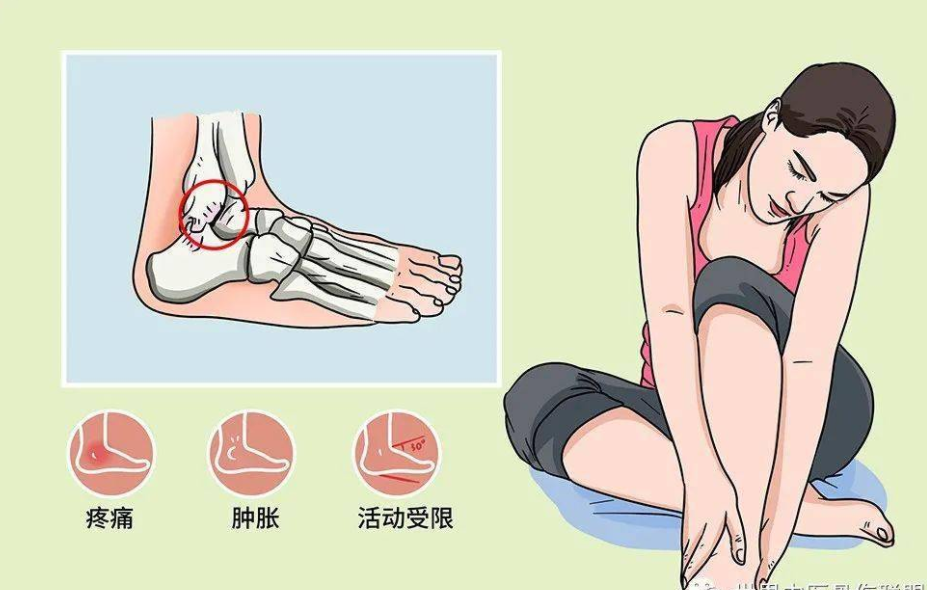 踝关节扭伤后反复疼痛,需警惕踝关节撞击综合征!