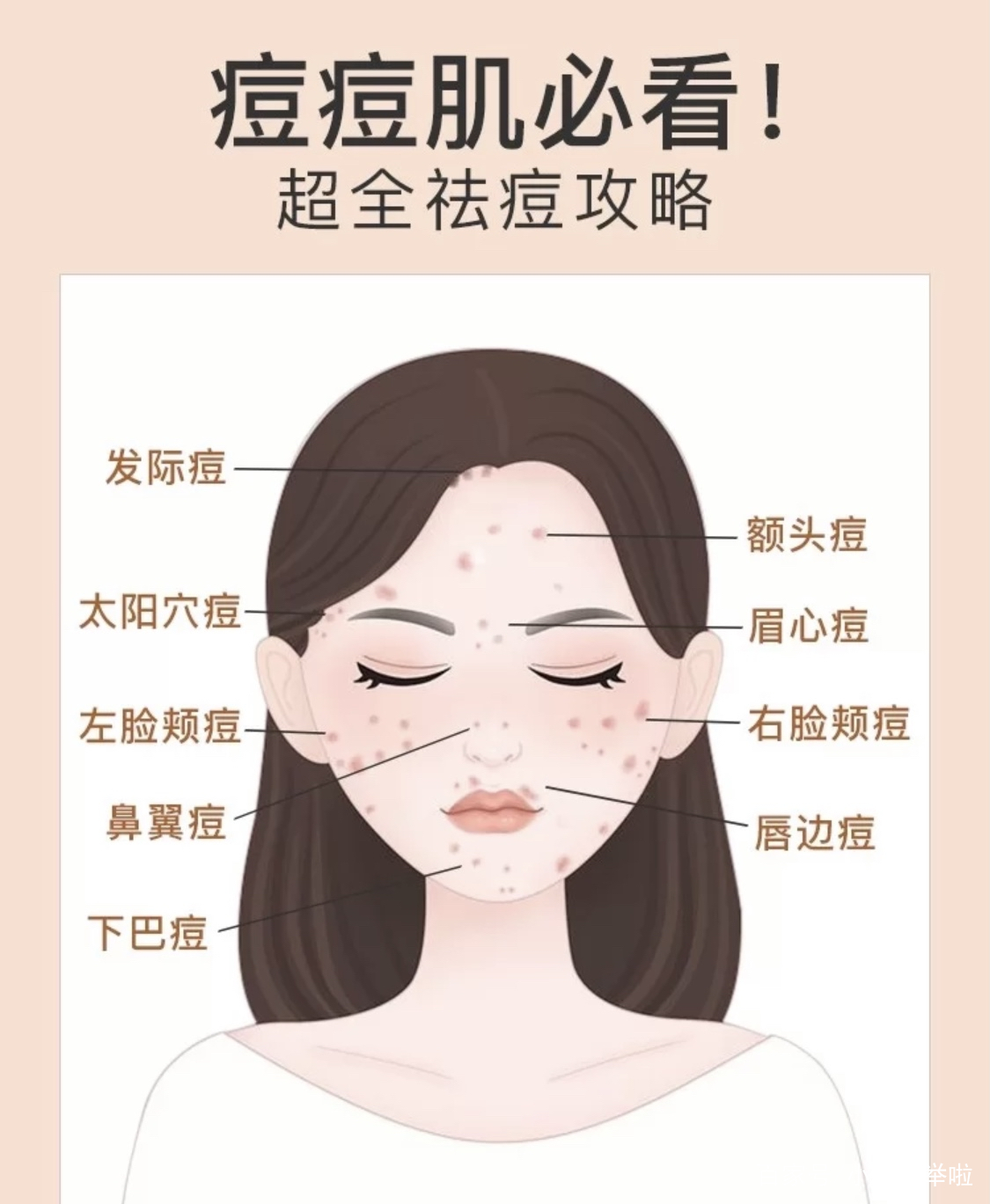 痘痘肌从哪入手？