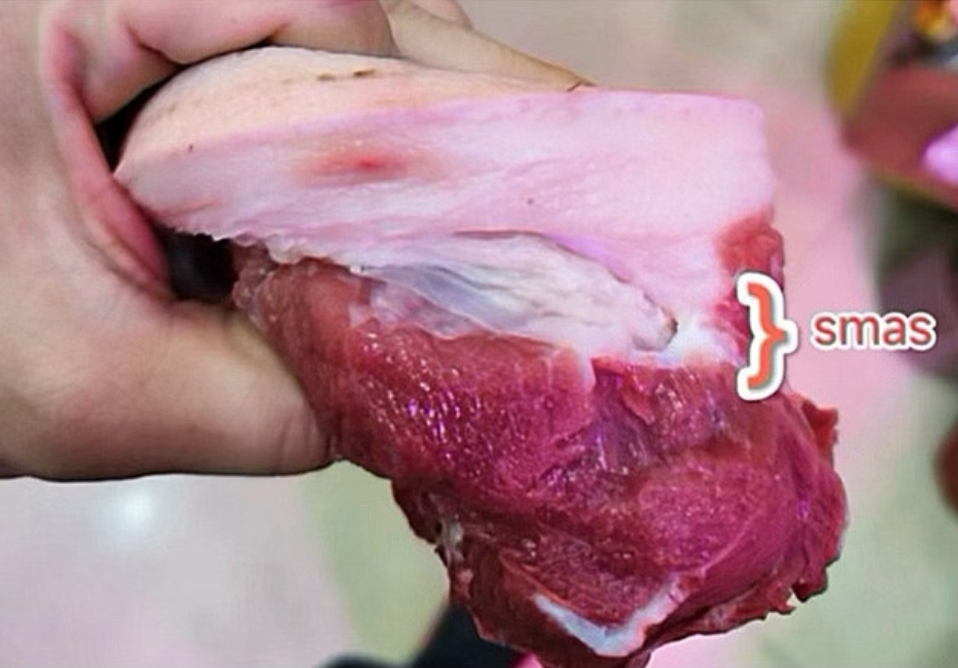 一坨肉让你认识筋膜层