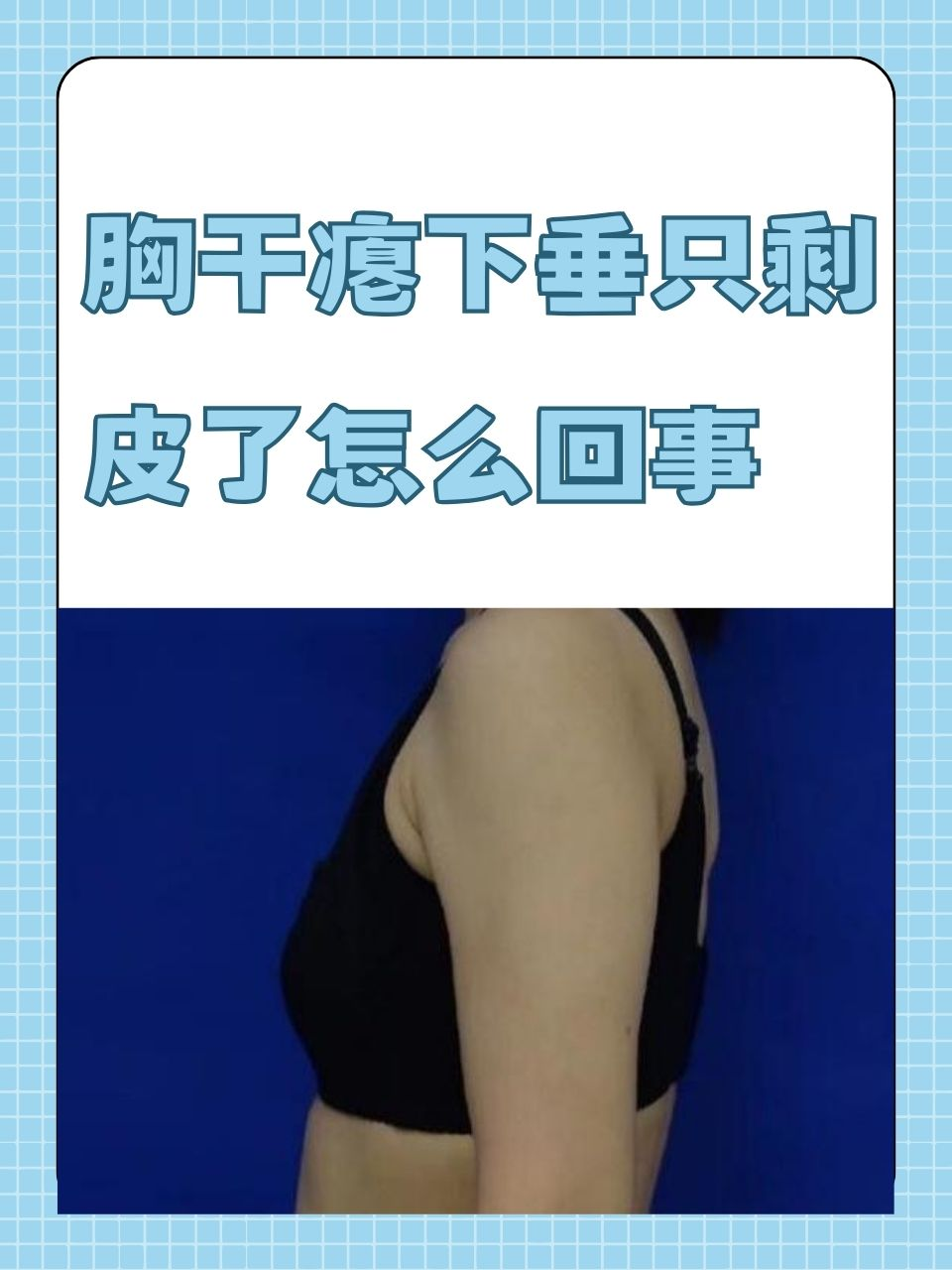 大胸为什么会下垂百科在线