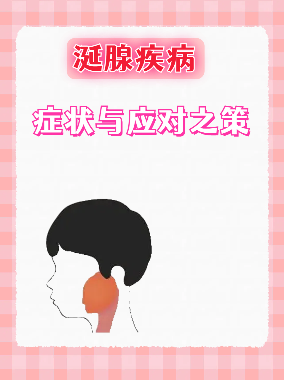 科普解读:涎腺,即唾液腺,分为