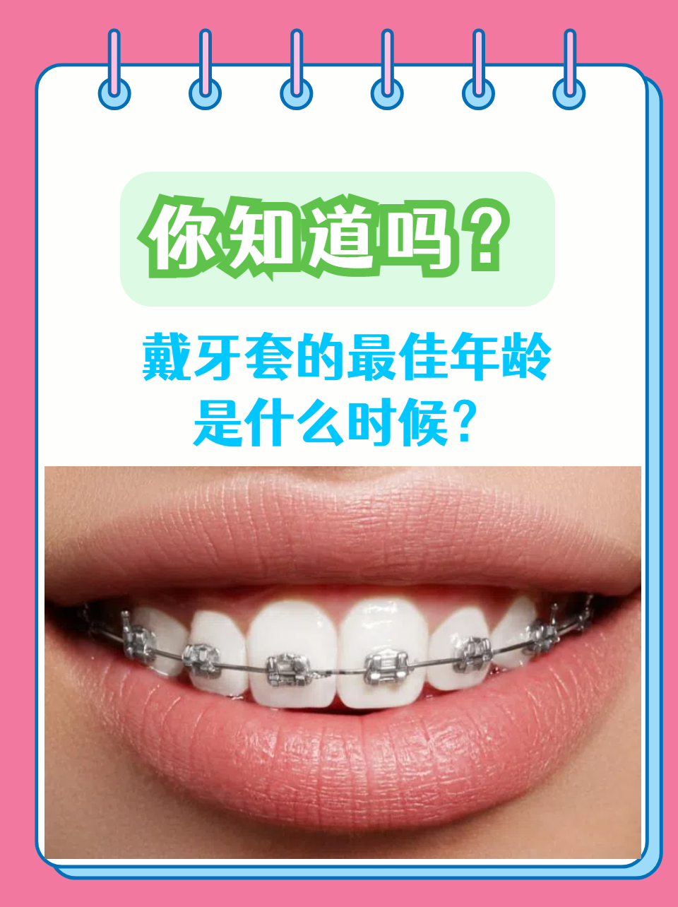 你知道吗?戴牙套的最佳年龄是什么时候?