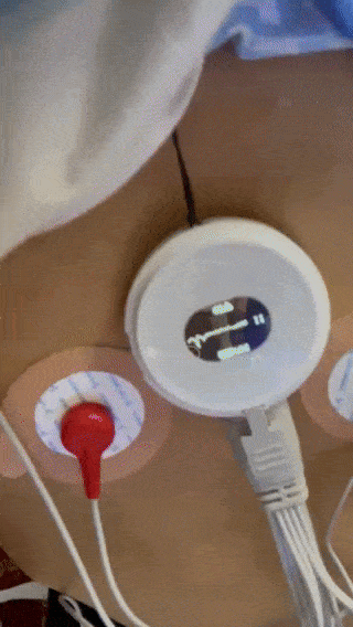 心异动即行动,马拉松跑者用lepod pro心电记录仪监测心电全记录