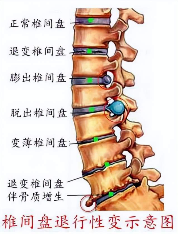 髋骨突出是什么原因图片