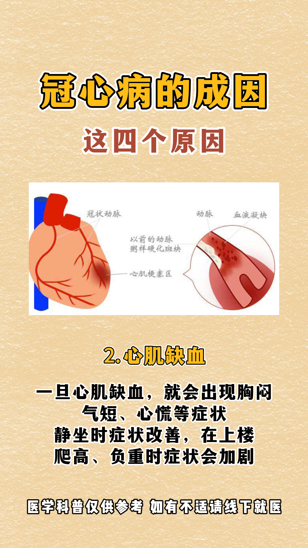 冠心病病因图片图片