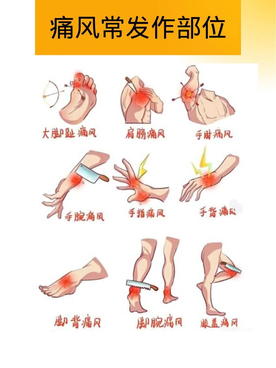 痛风来袭?别慌,老中医的风趣妙招来救场!