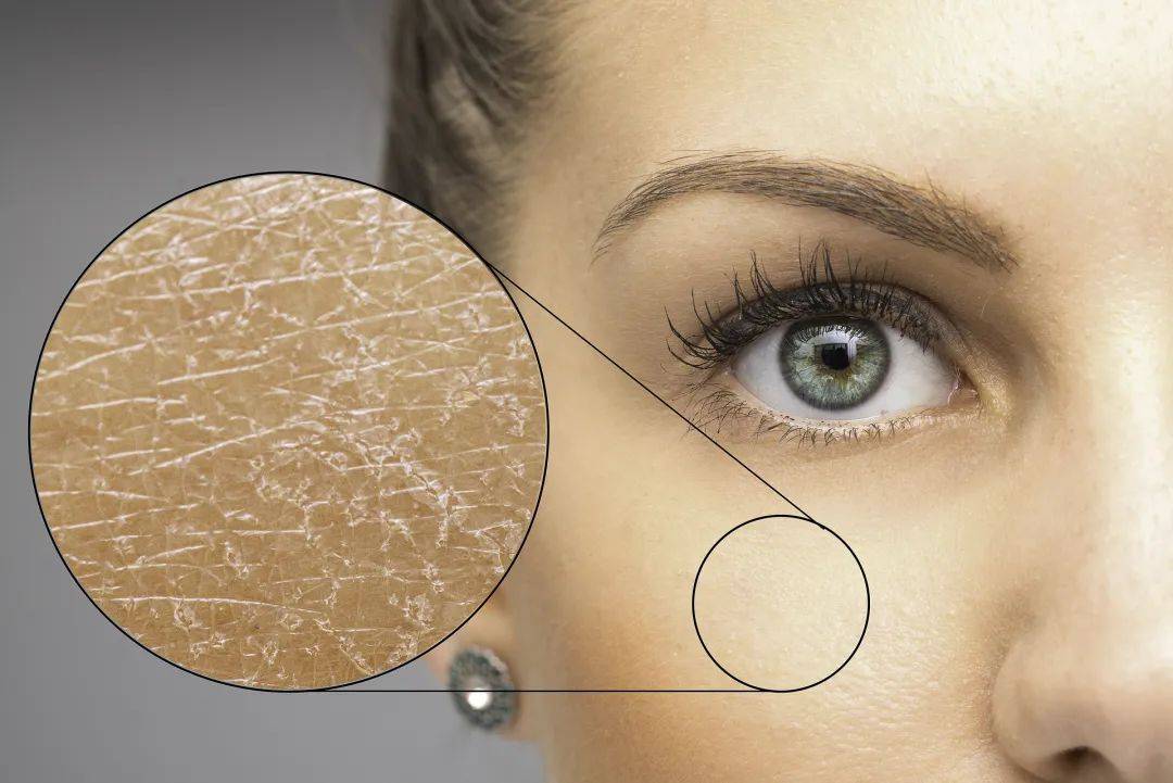 春季皮肤干到起皮?解锁科学保湿的真相!