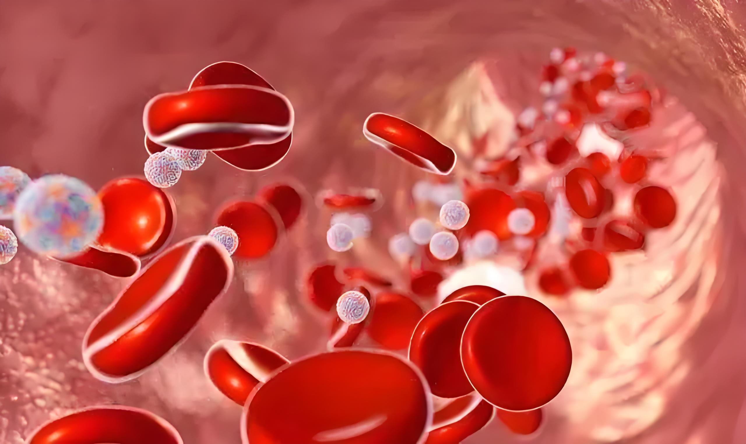 再生障碍性贫血出现发烧发热应该怎么办?