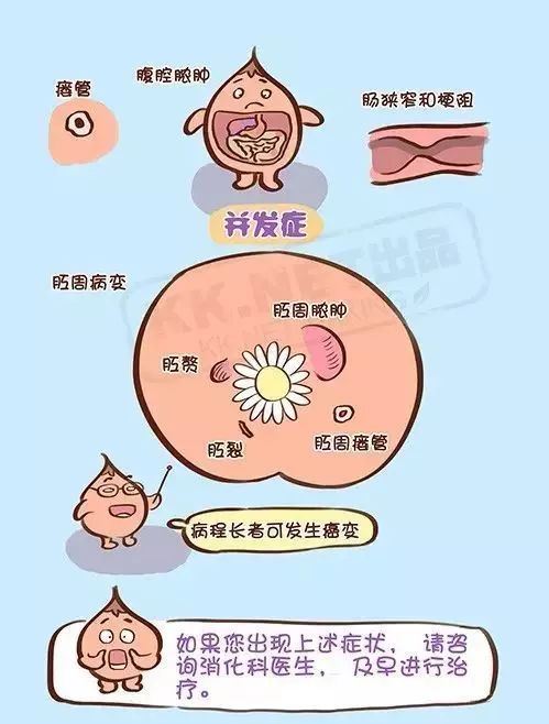 克罗恩病善存图片