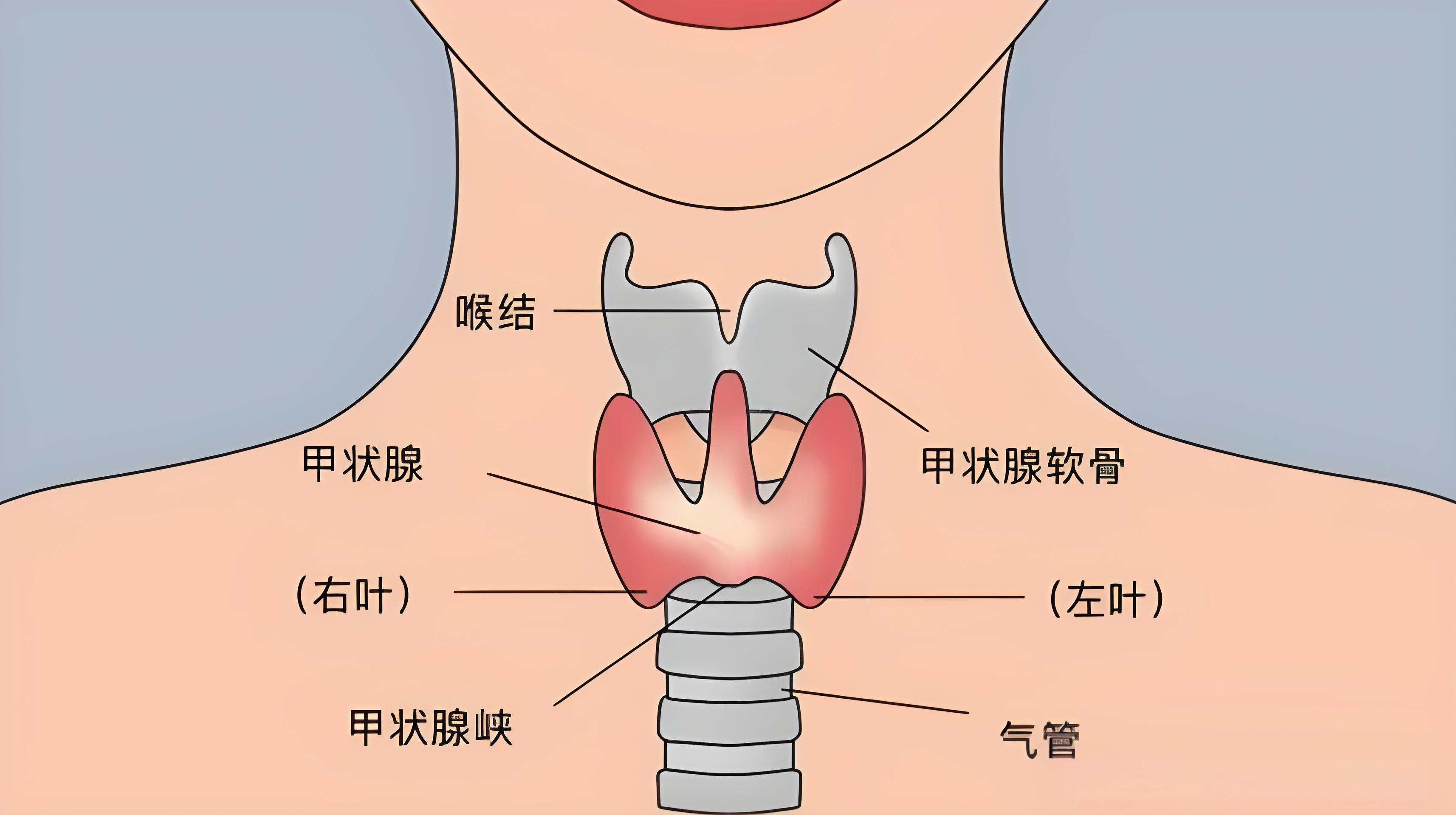 为什么会得甲状腺癌图片