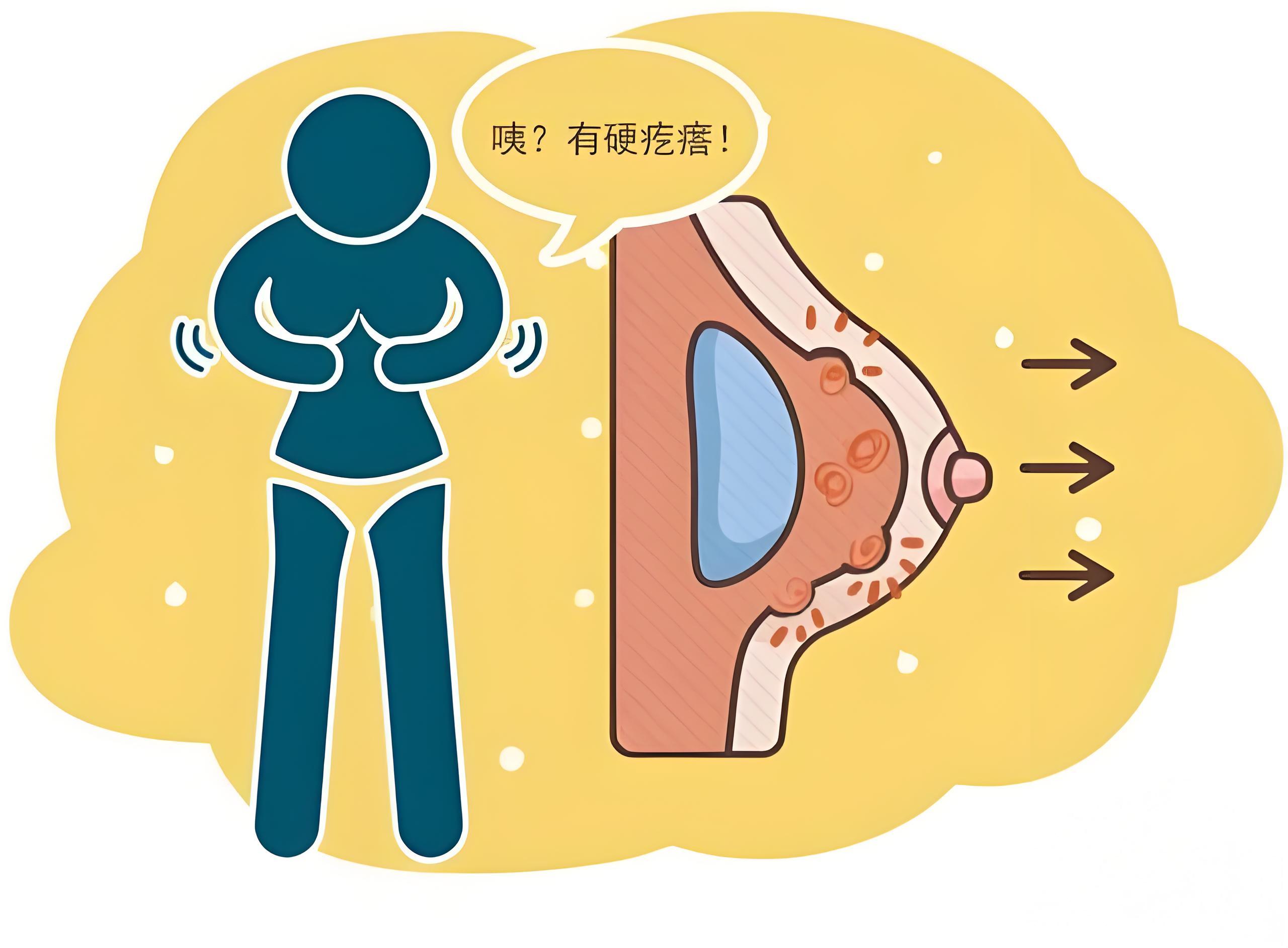 女性乳腺增生多做这些,缓解身体负担