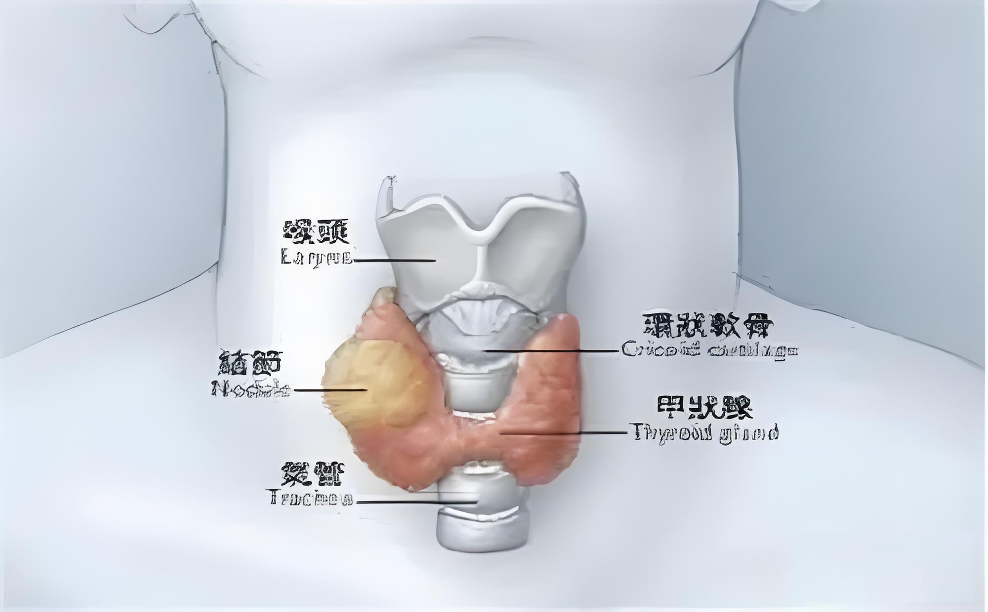 甲状腺结节长在哪里图片