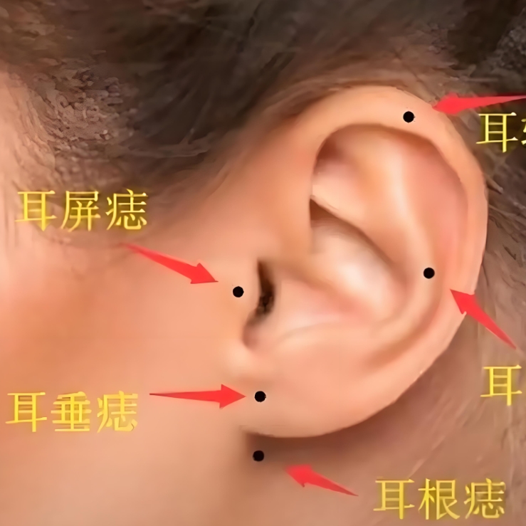 耳朵上有这颗痣的人,天生带财库!老祖宗说的"富贵痣"长在哪?