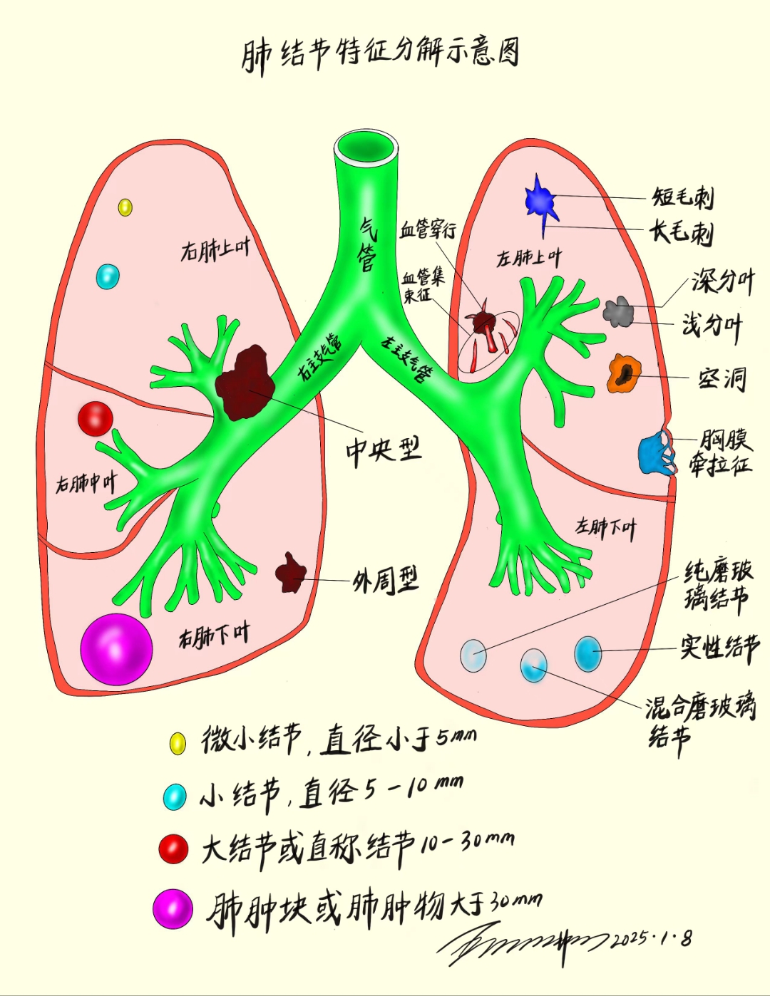得了肺结节,别怕!教你如何正确对待!