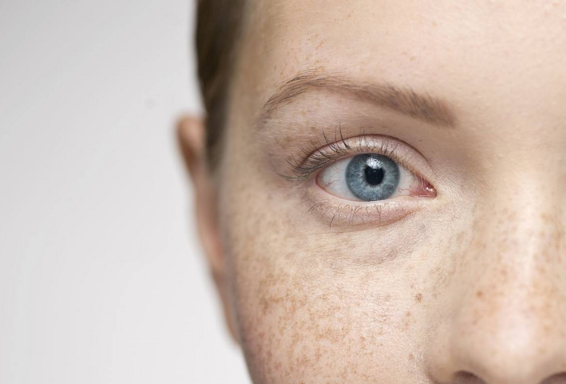 脸上色斑多?这8种"祛斑食物"赶紧吃起来,越吃越漂亮