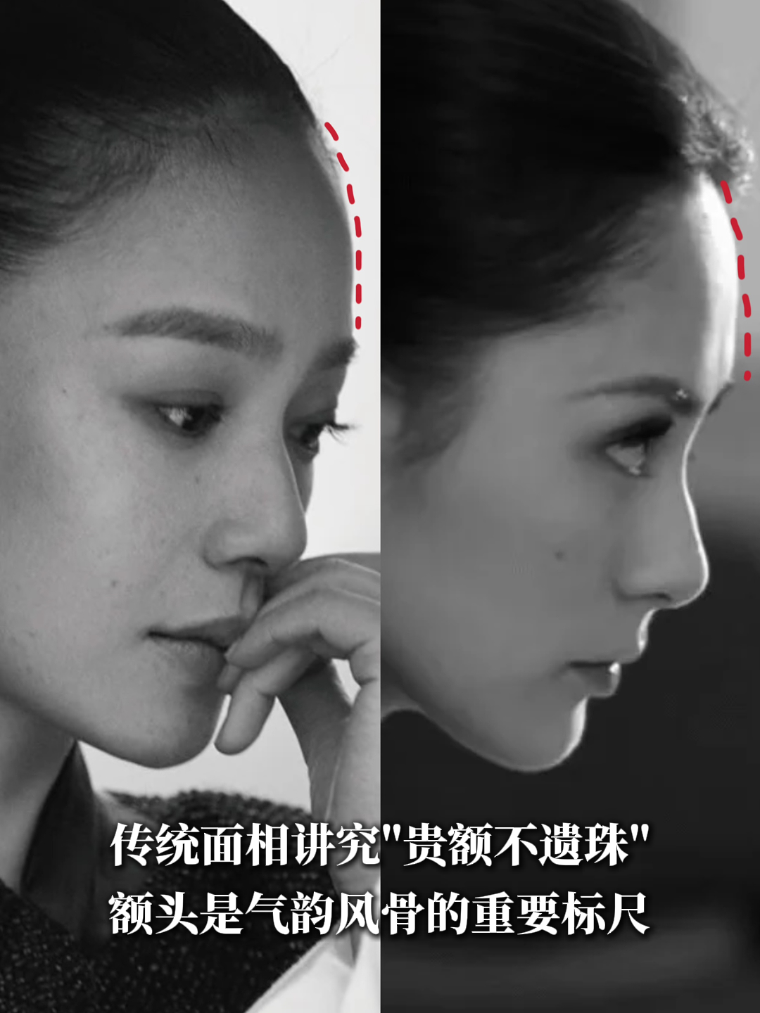 额头审美,永远在过与不及的微妙平衡之间