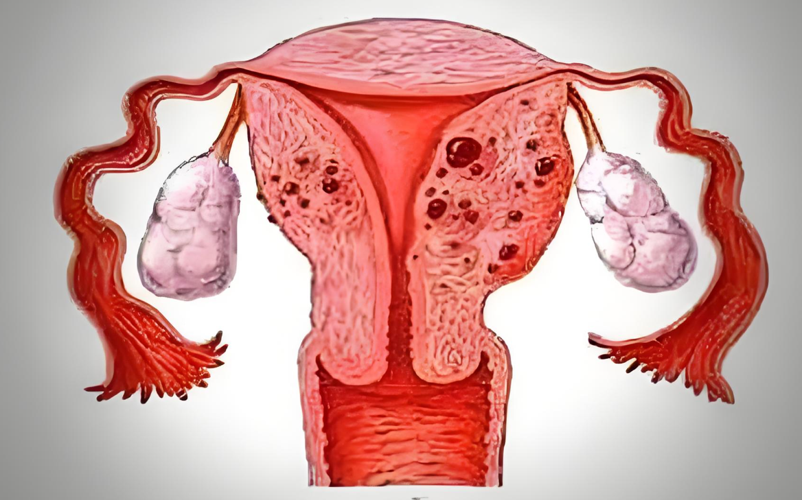 子宫为什么会有淤血 子宫为什么会有淤血