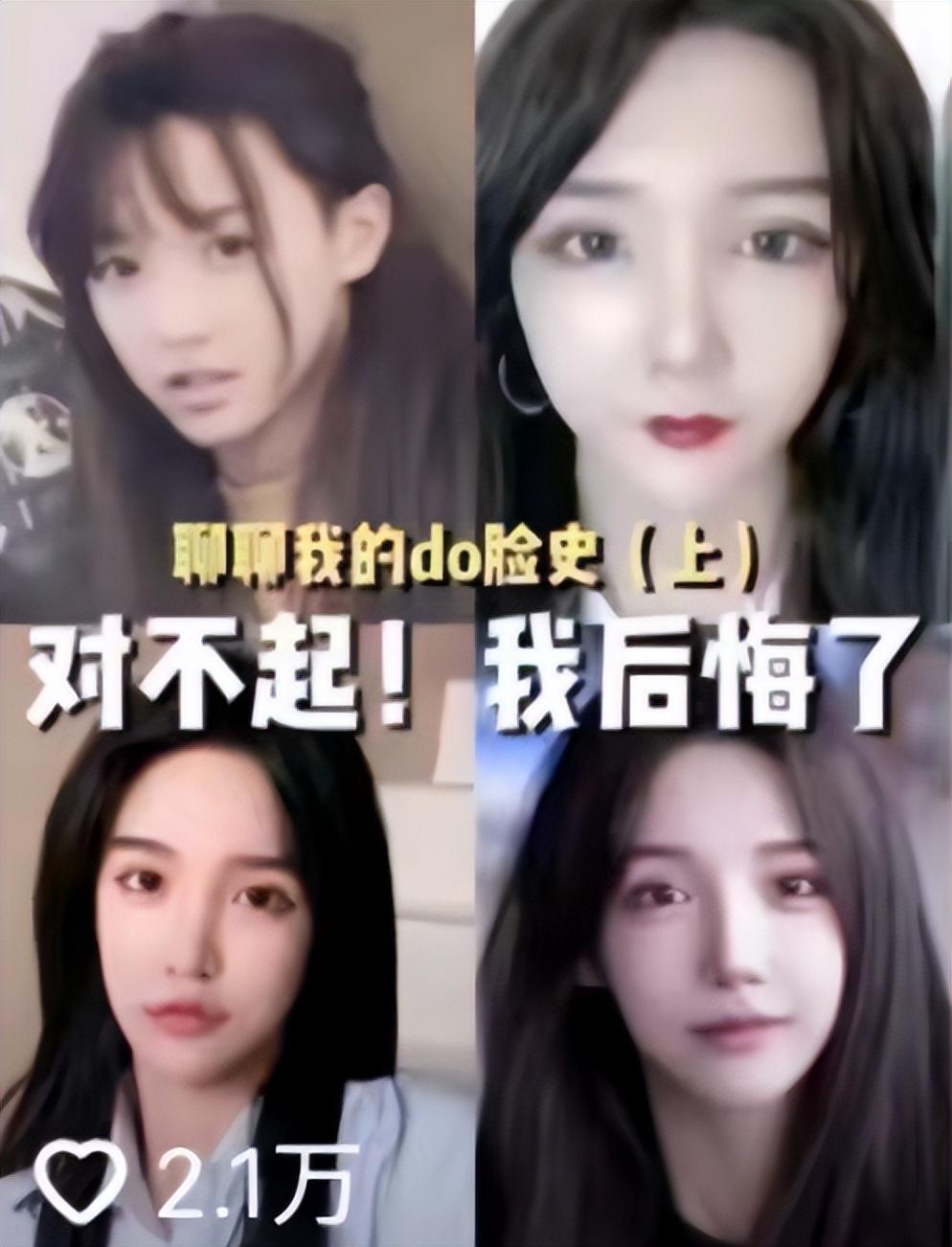 脸部前后60次"修整",变性网红艾比分享整容经历,坦言:后悔了