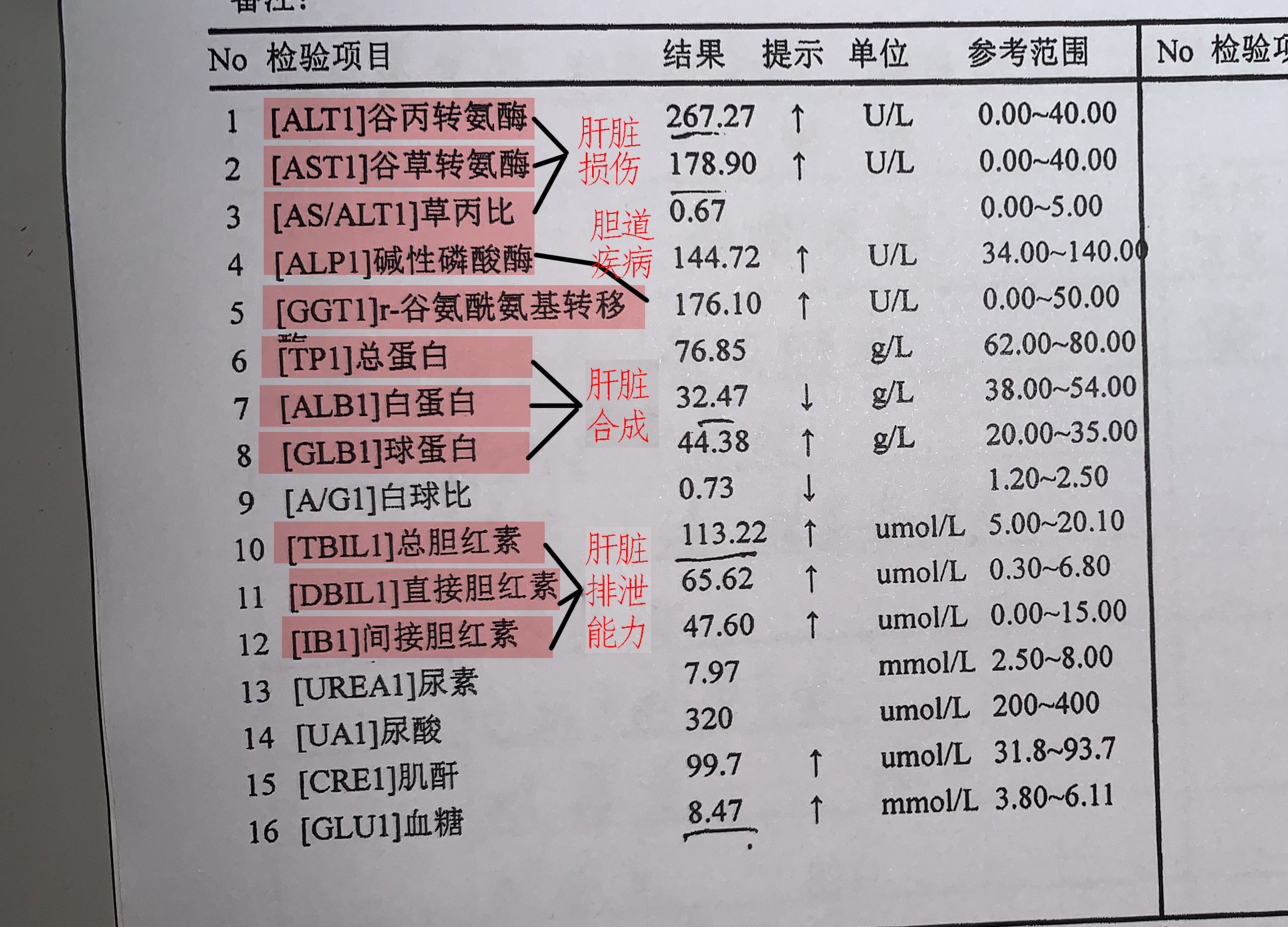 一分钟教您,看明白肝功能化验单