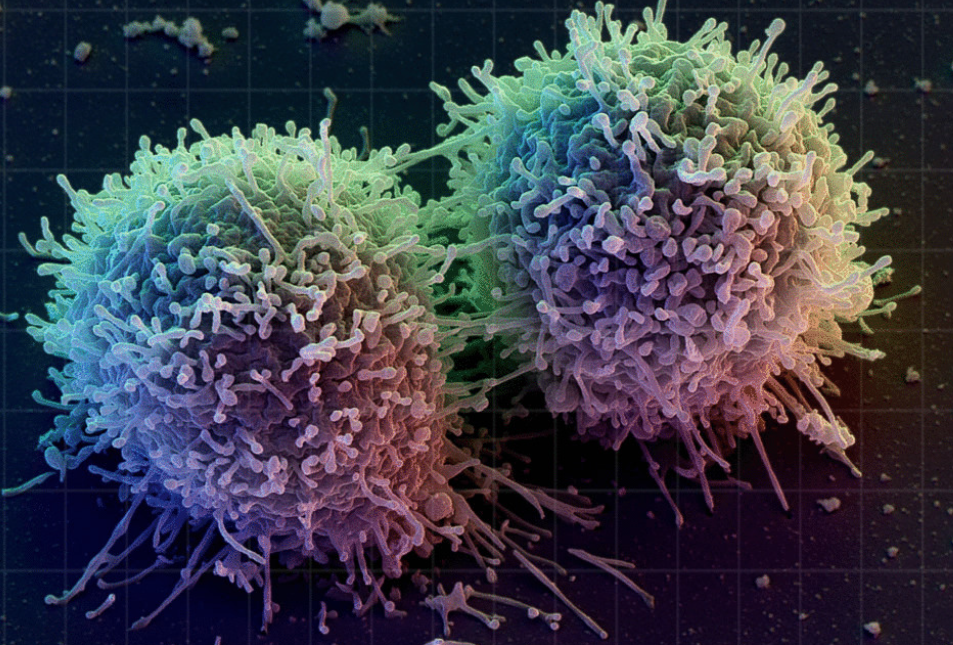 自然杀伤细胞:免疫系统的"前线战士"