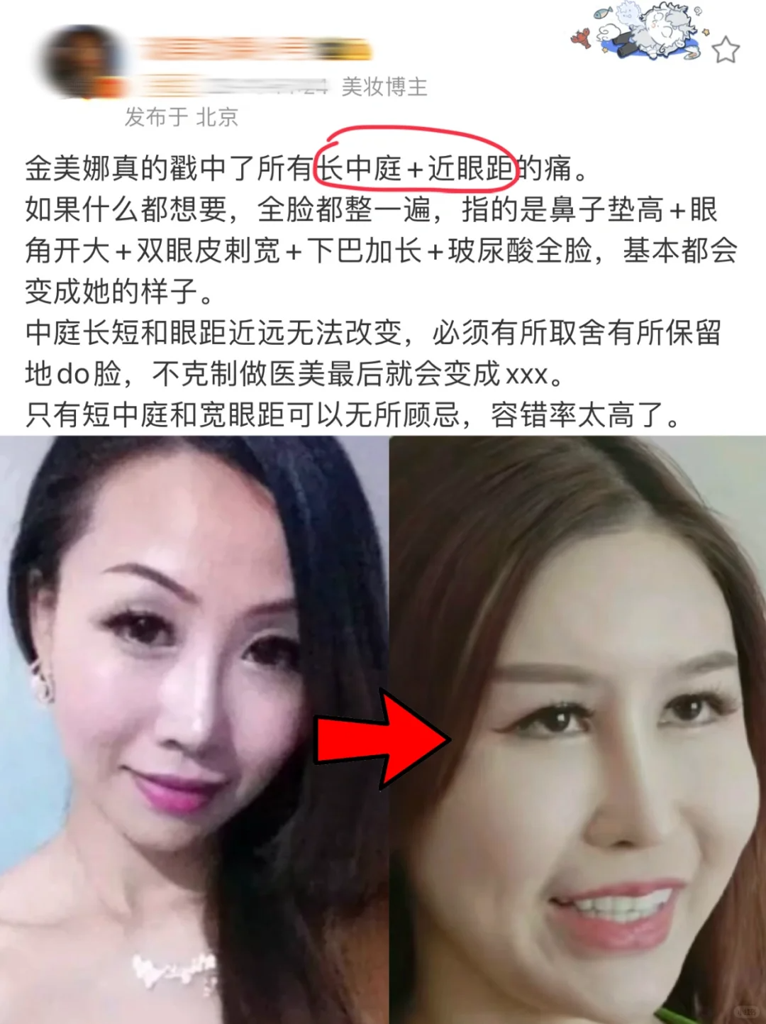 看了金美娜才知道,整容真的看底子