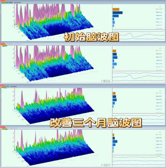脑波检测仪韩国多元neuroharmony在数字教育创新上的应用和落地